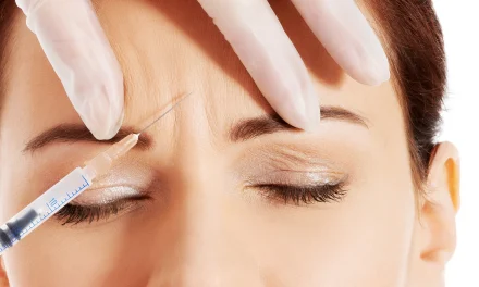What is preventive botox?
