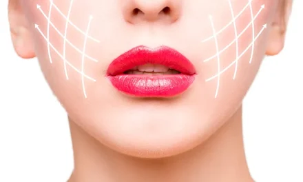 What is face radiofrequency application?