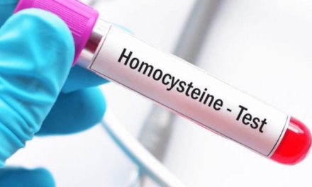 Homocysteine ​​Height: How many homocysteine ​​should be?