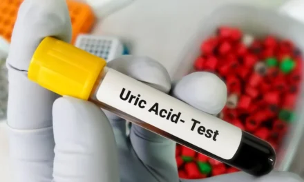 How does uric acid fall? Does garlic raise uric acid?